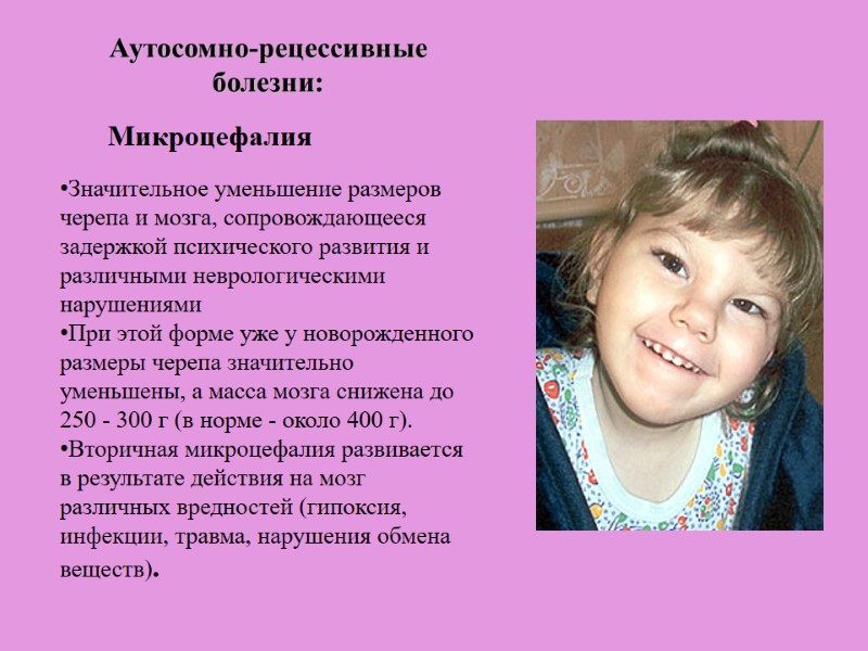 Значительное уменьшение размеров черепа и мозга, сопровождающееся задержкой психического развития и различными неврологическими нарушениями